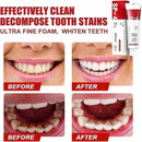 Yayashi Sp-4 Ultra Whitening Toothpaste Probiotic Stain Remover 120gm / Stain Removing Toothpaste, Protects Gums Freshens Breath, For Everyone