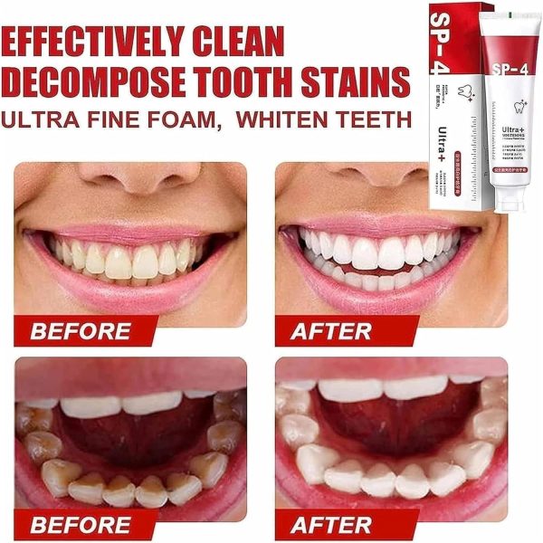 Yayashi Sp-4 Ultra Whitening Toothpaste Probiotic Stain Remover 120gm / Stain Removing Toothpaste, Protects Gums Freshens Breath, For Everyone
