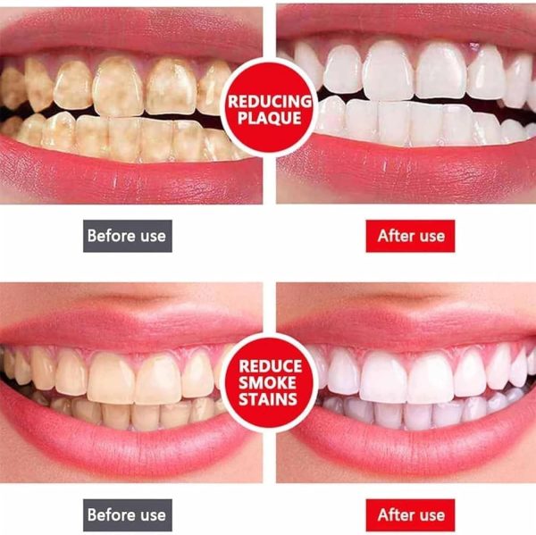 Yayashi Sp-4 Ultra Whitening Toothpaste Probiotic Stain Remover 120gm / Stain Removing Toothpaste, Protects Gums Freshens Breath, For Everyone